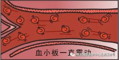 血小板是正常值的三倍？專家提醒小心血栓和出血！