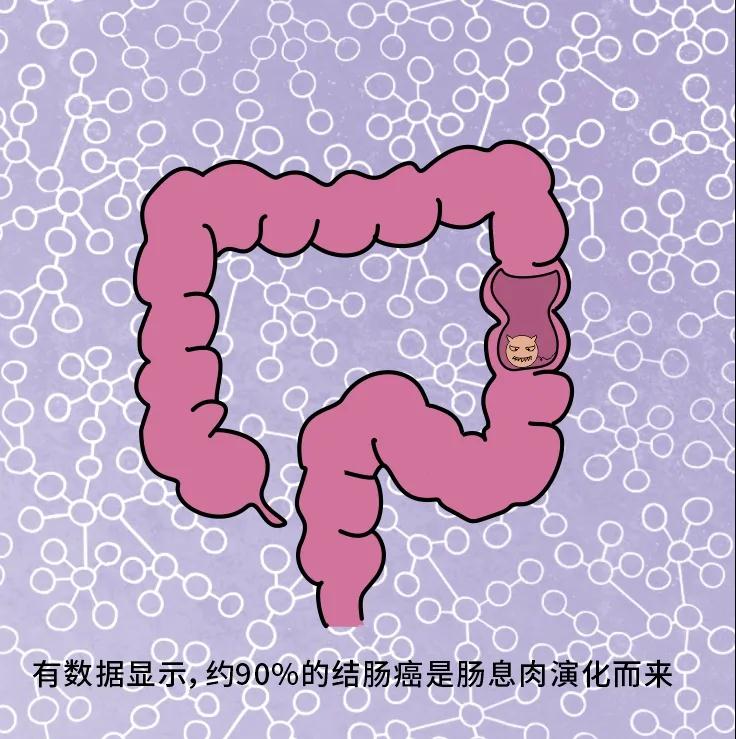 奪走“黑豹”生命的結腸癌，到底什么來頭？