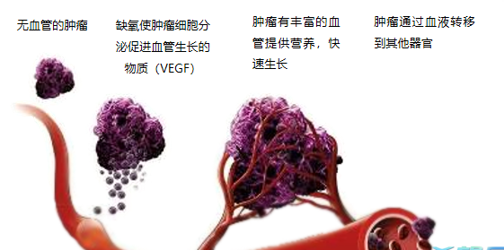 晚期腫瘤為什么會復(fù)發(fā)轉(zhuǎn)移？