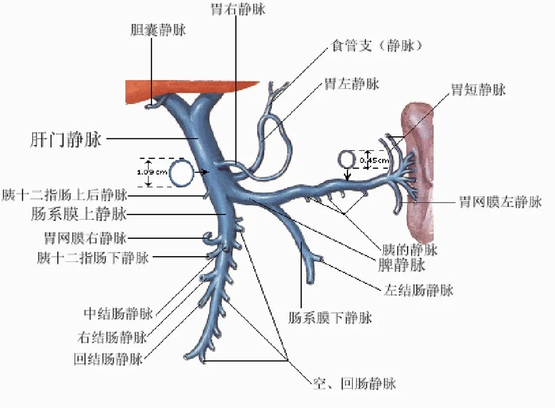 反復(fù)嘔血、黑便怎么辦？TIPS手術(shù)能解決