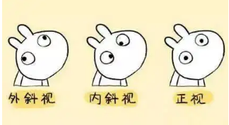 小baby老歪著頭？警惕斜頸! 這樣糾正……