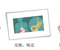 關(guān)愛身體健康，輕松檢查胃腸