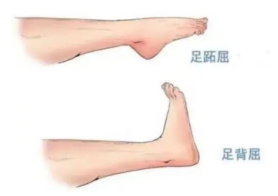 扭胯小連步、動(dòng)感搖花手……“科目三”雖火，運(yùn)動(dòng)損傷也要防！